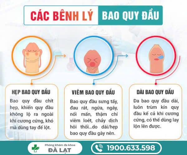 Hình ảnh minh họa